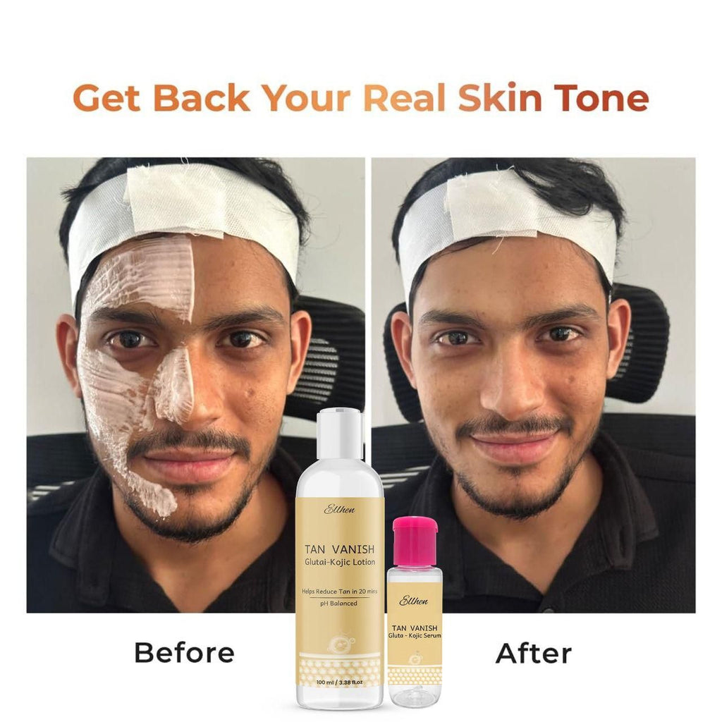 Tan Vanish Gluta Kojic Lotion & Gluta Kojic Serum | Brightening & Pigmentation Care | 100 ml