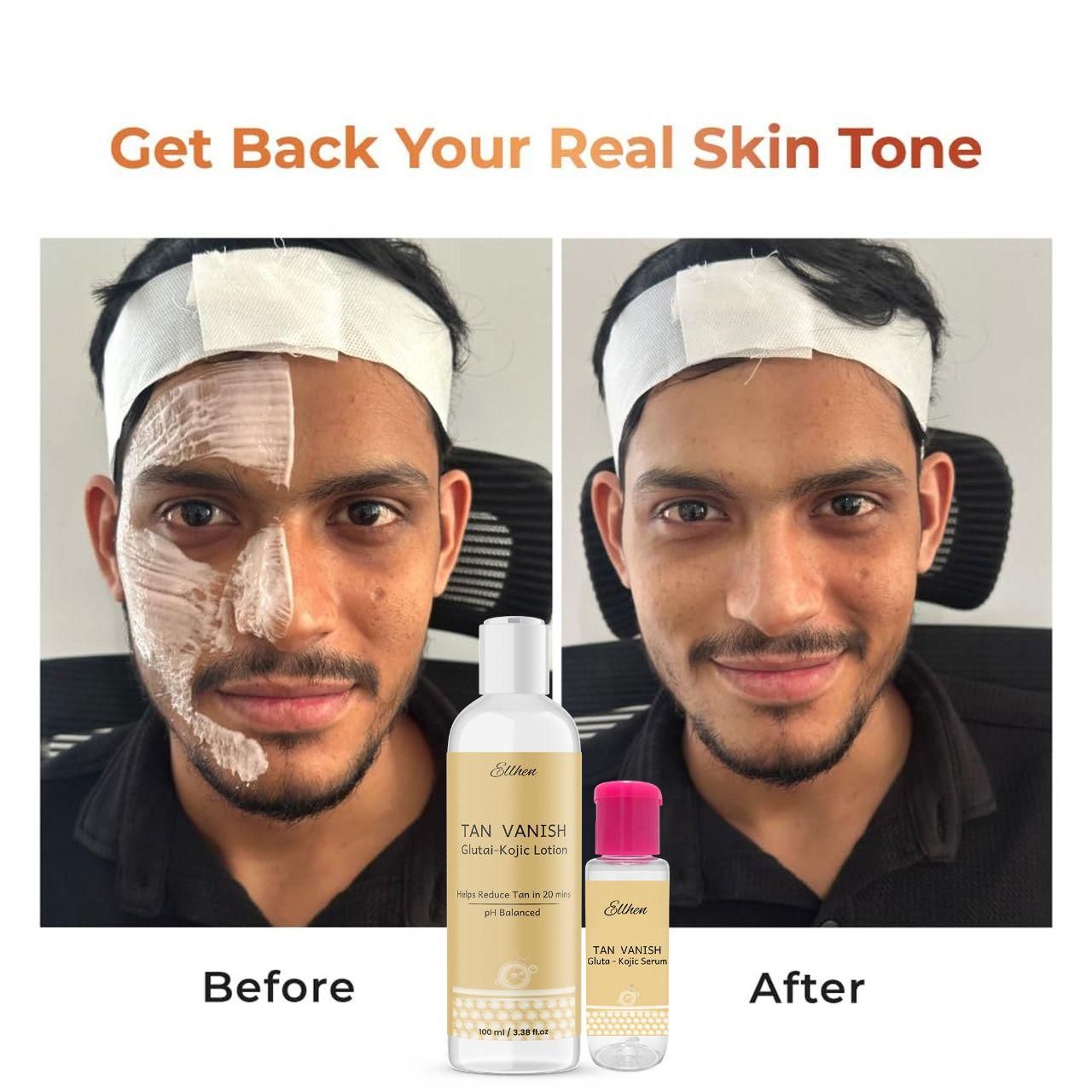 Tan Vanish Gluta Kojic Lotion & Gluta Kojic Serum | Brightening & Pigmentation Care | 100 ml