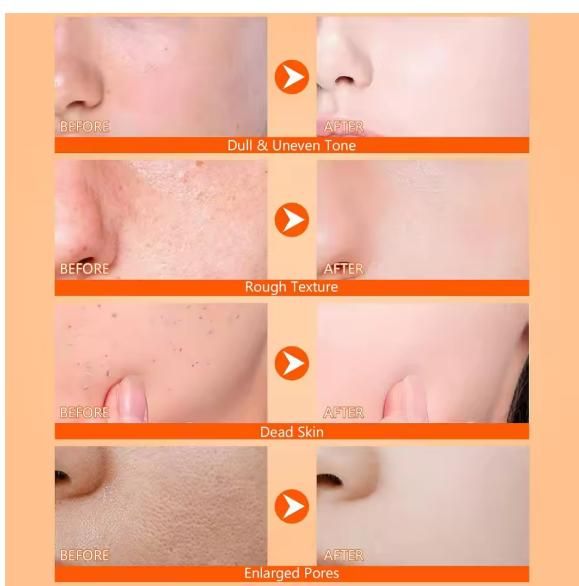 Shiana Exfoliating Kojic Acid Turmeric Spray | Skin Brightening & Tan Removal | 400 ml x 2 (Pack of 2)