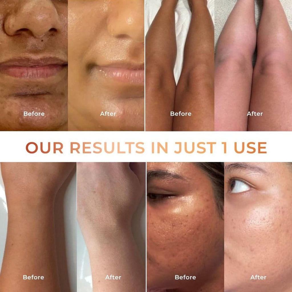 Tan Vanish Gluta Kojic Lotion & Gluta Kojic Serum | Brightening & Pigmentation Care | 100 ml